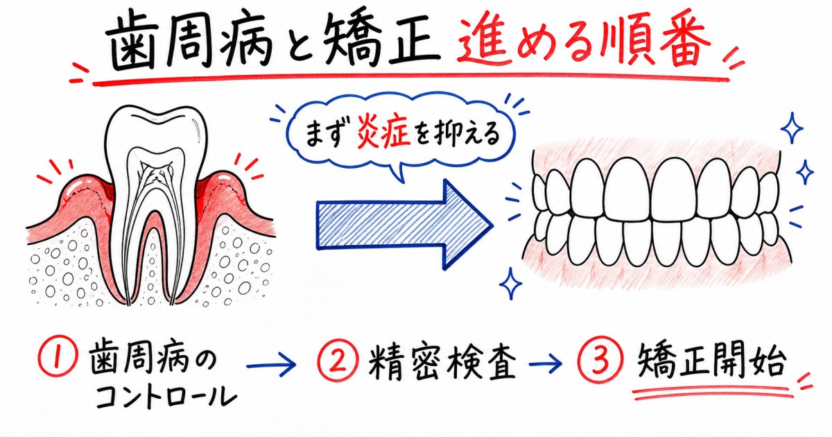 歯周病でも矯正できる？始める順番や失敗を防ぐ注意点を解説