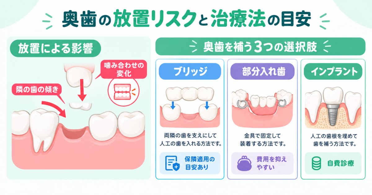 奥歯を抜いたまま放置は危険？噛み合わせへの影響と費用比較