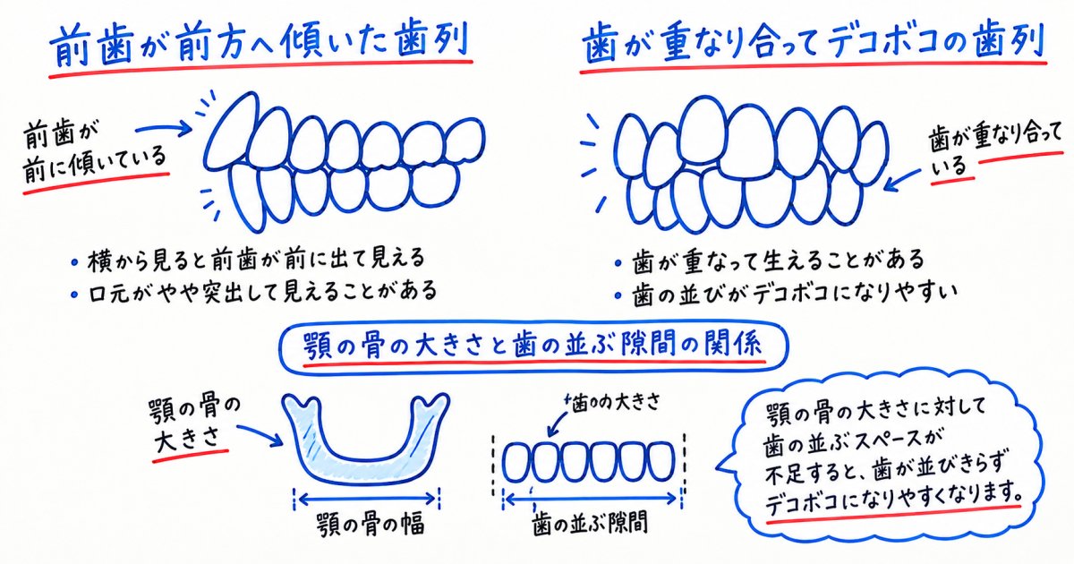 前歯が飛び出す・ガタガタになる仕組みと遺伝の関係