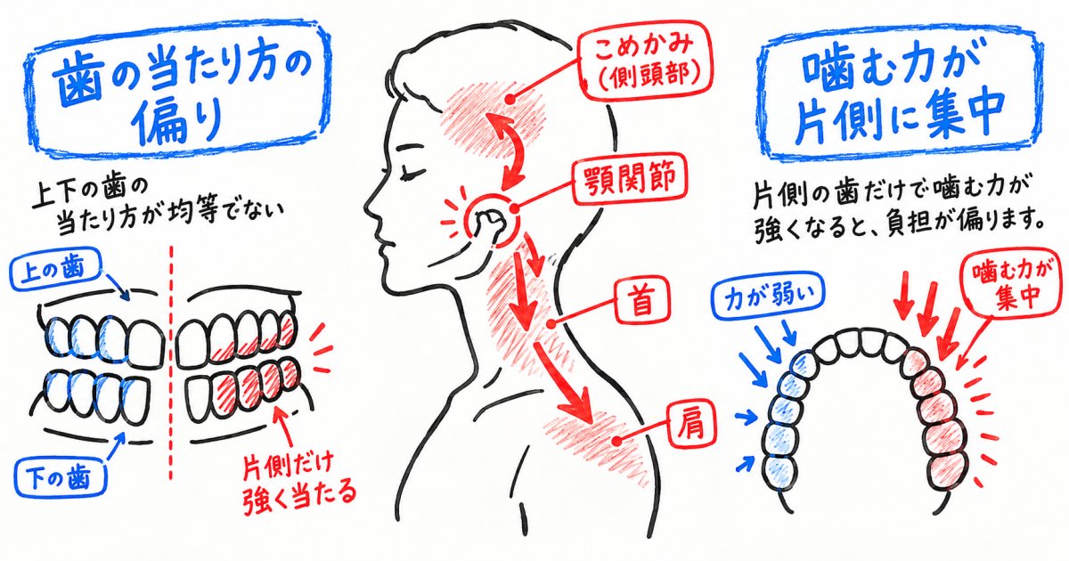 噛み合わせの乱れが全身に及ぼす負担