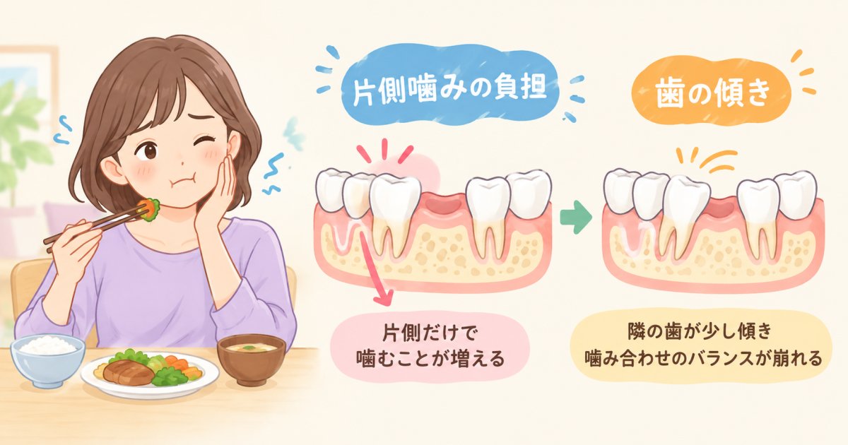片側噛みが続くとどうなる？奥歯を失ったまま放置するリスク