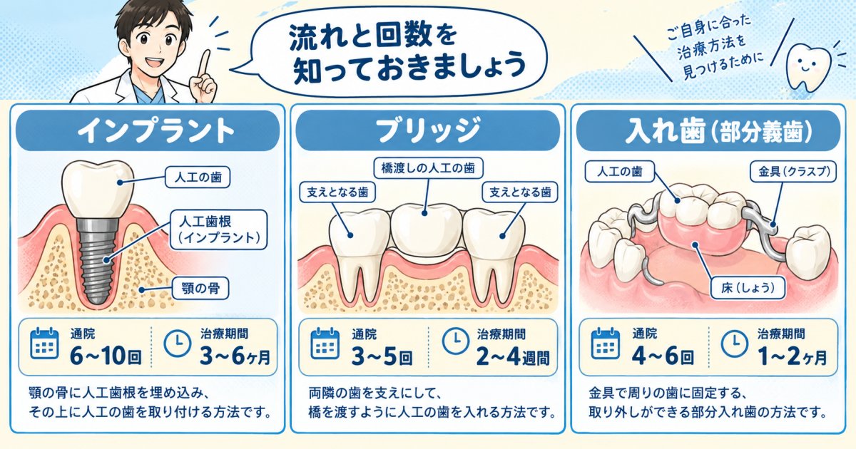 インプラント・ブリッジ・入れ歯、治療の流れと通院回数の目安