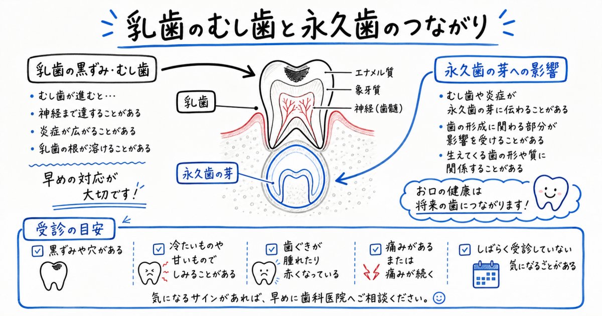 「生え変わるから大丈夫？」乳歯のむし歯を放置する影響と受診の目安